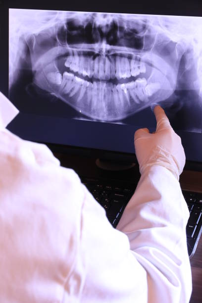 Best Broken or Chipped Tooth Repair in Lancaster, OH